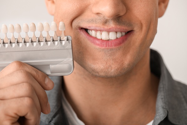 Surprising Benefits Of Getting Dental Veneers